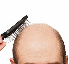 Hair Loss and Hair Fall Treatment